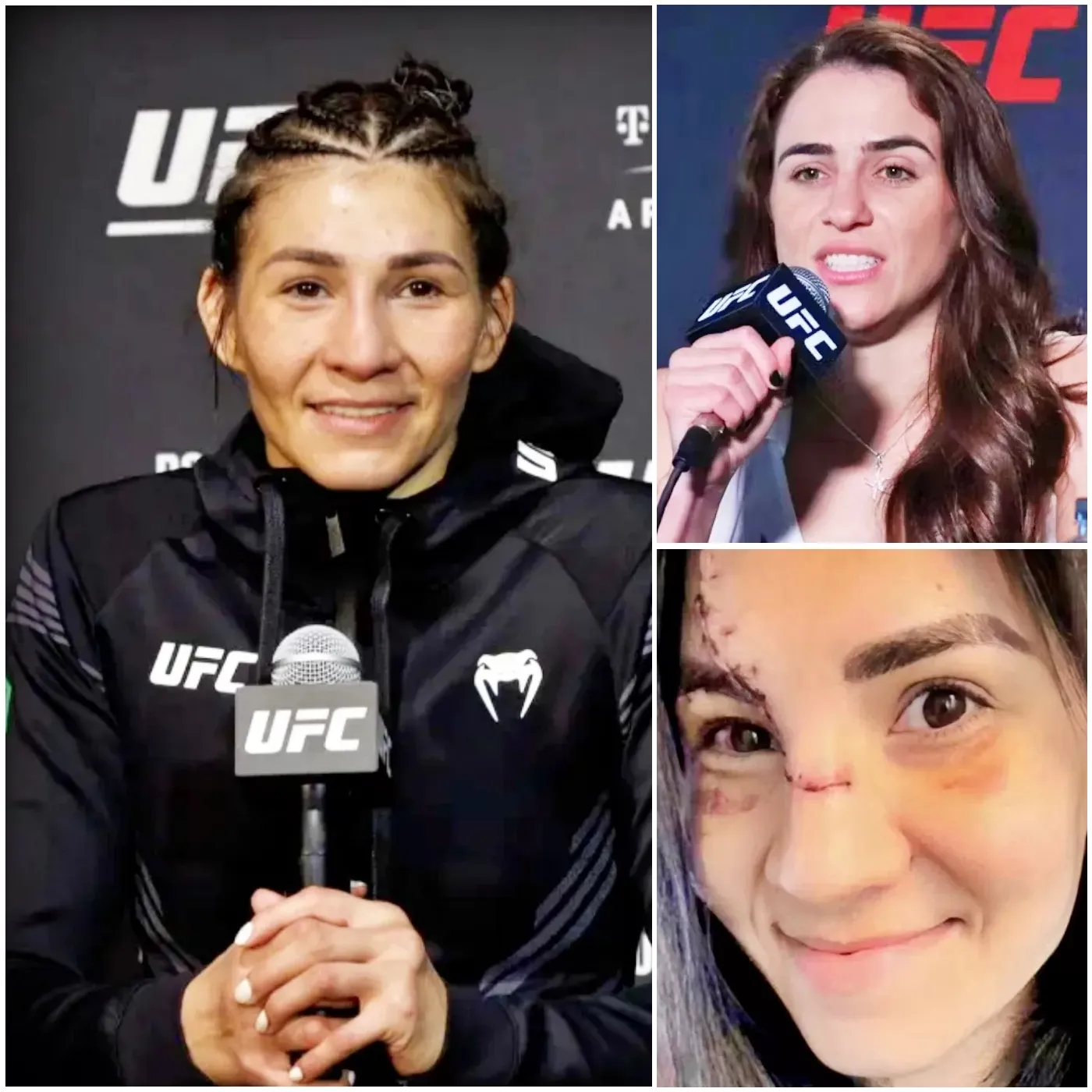 “Deuda De Sangre Por Sangre”: Irene Aldana Advierte Que Norma Dumont Le Hará Pagar Por Esta “Cara” El Día De La Revancha En Ufc