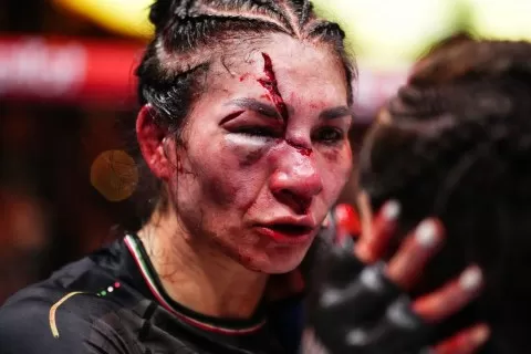 “Deuda De Sangre Por Sangre”: Irene Aldana Advierte Que Norma Dumont Le Hará Pagar Por Esta “Cara” El Día De La Revancha En Ufc