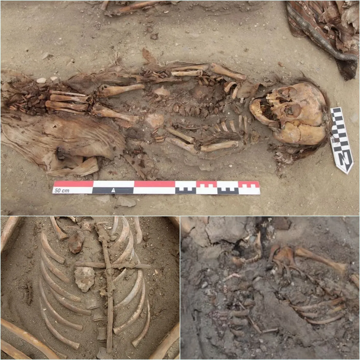 Archaeologists Have Discovered 500-Year-Old Skeletons Of Inca Children That Exhibit Signs Of Smallpox.