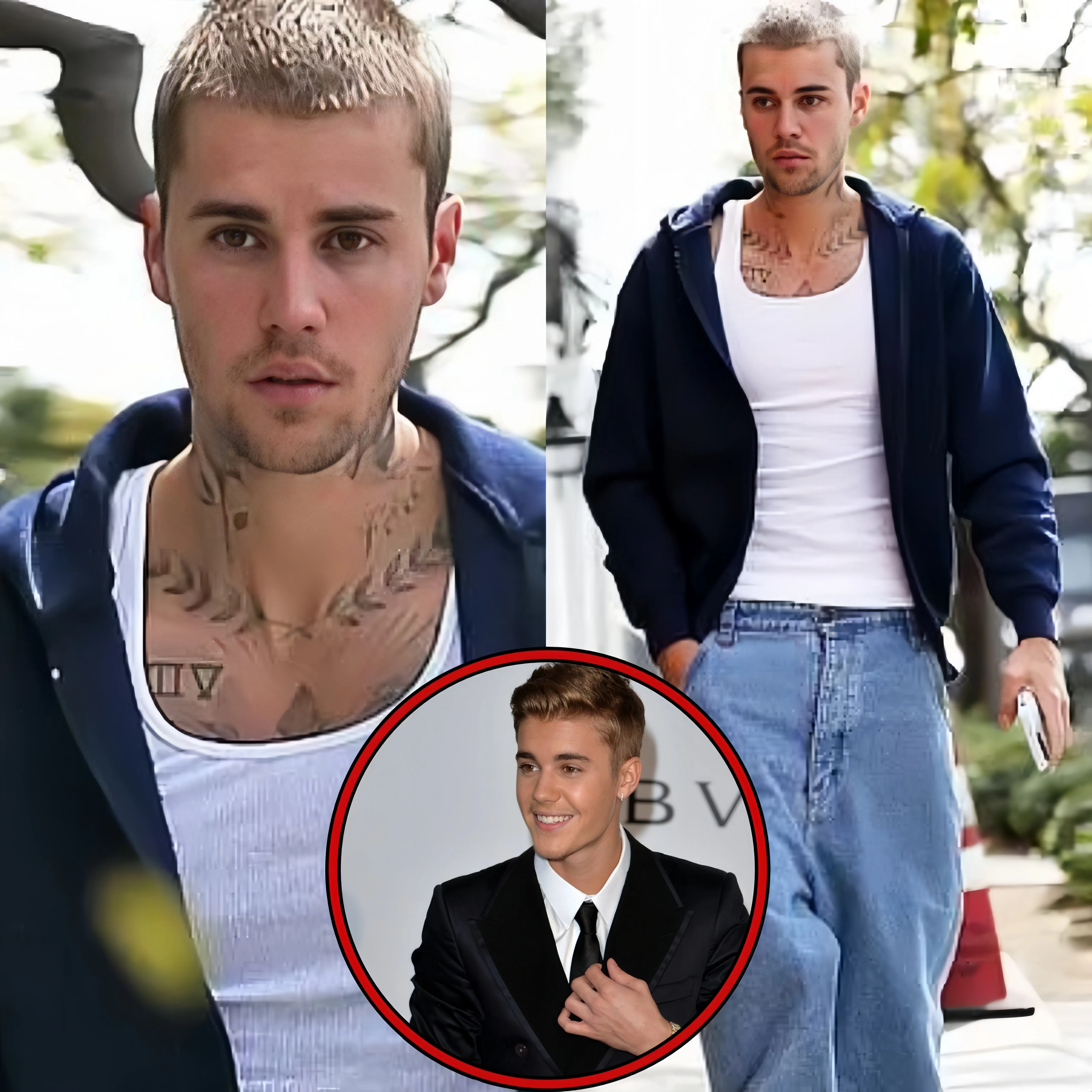 Justin Bieber Was Spotted In La Looking Stressed As Videos Resurface Of Him And Pdiddy Rumors Circulating That He Had A Hair Transplant, Alot Of False Accusations Being Thrown Around And He Has Asked Everyone To Please Give Him Some Space To Breathe. 😢